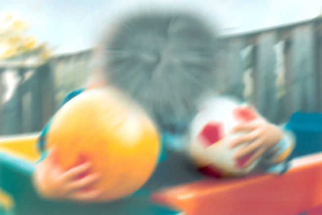Degeneración Macular